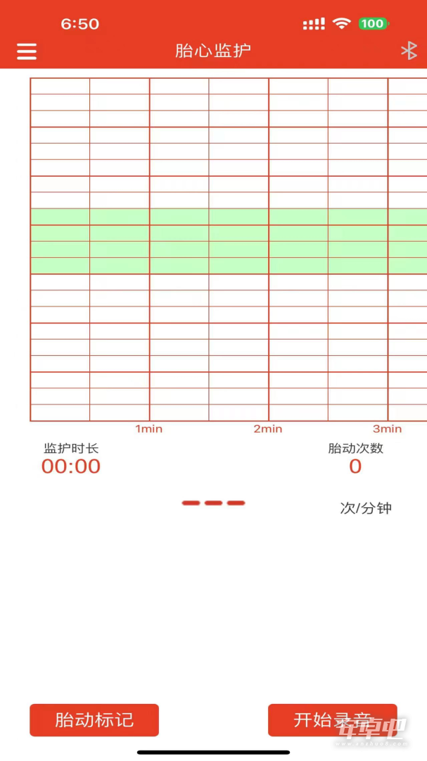 左点胎心仪2